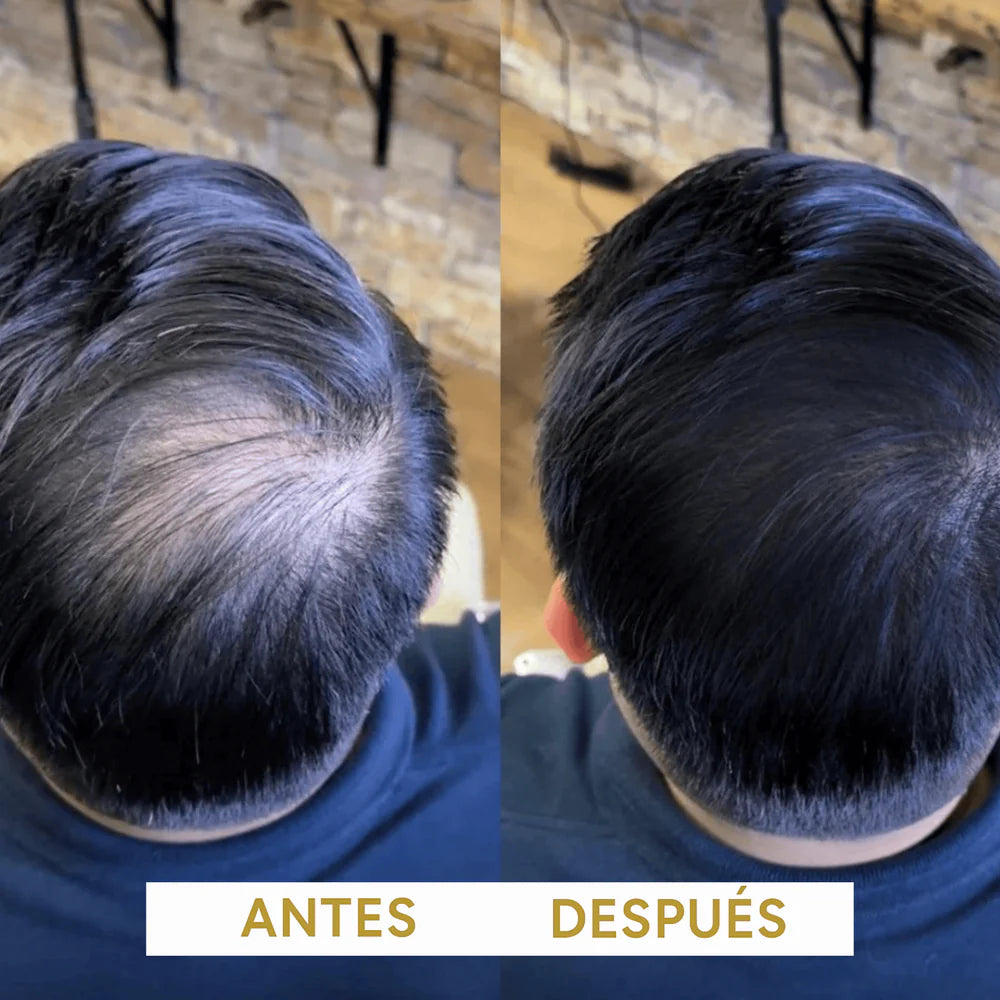 🌑 Fibra Capilar – Adiós Calvas en Segundos