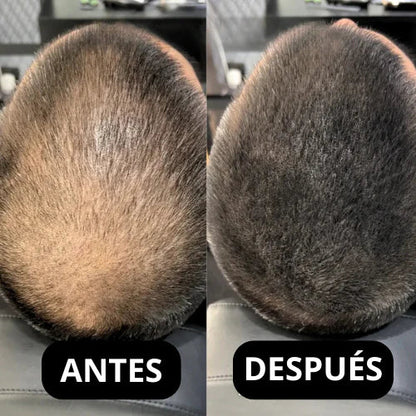 🌑 Fibra Capilar – Adiós Calvas en Segundos